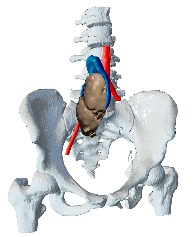 FabLab 3D Hospital Marañón tweet media