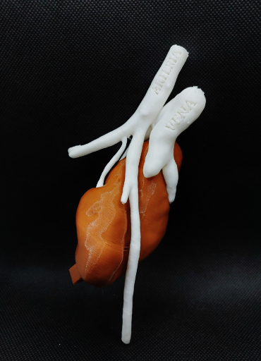 FabLab 3D Hospital Marañón tweet media