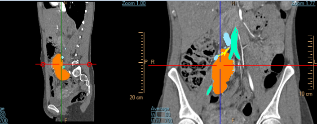 FabLab 3D Hospital Marañón tweet media
