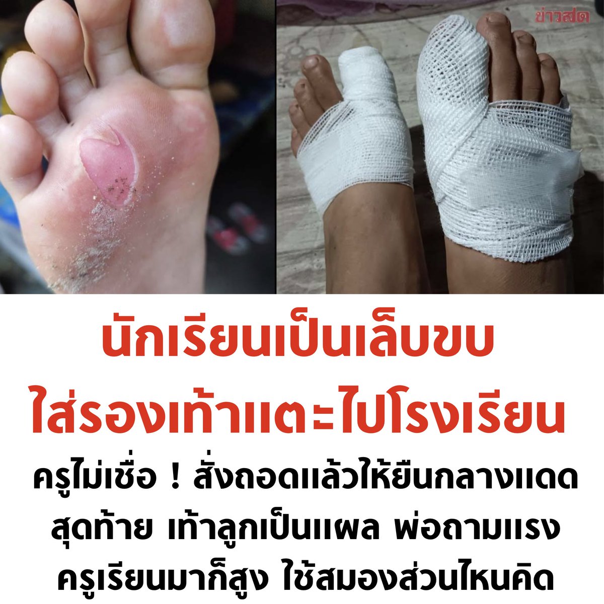 ก่อนเป็นครู เป็นคนให้ได้ก่อน