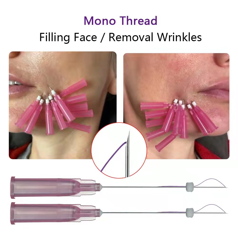 fannych19139642's tweet image. pdo mesh thread used for deep wrinkles filling, especially for naso and neck parts. #pdothread #pdomesh #pdothreadmesh #facial #facelifting #pclmeshthreads #pclthreading