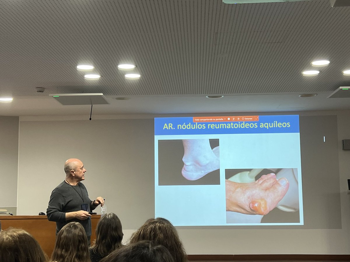 mardagaori's tweet image. Matinal amb enfocament 💯 clínic. Com abordar la patologia del peu en #artritisreumatoide #apso ❓
🏆 Un honor tenir Dr. Jesús Rodriguez de @hbellvitge #reumatologia L’expert amb majúscules en patologia del peu reumatic 🦶🏽🦶🏽@SCReuma