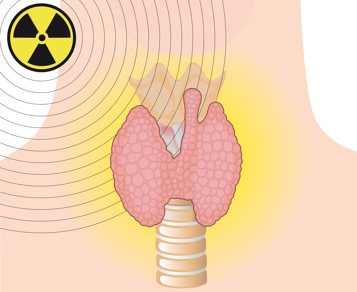 aecat_es's tweet photo. ⚠️¿Vas a someterte a un tratamiento con radioyodo? ⚠️ 

El Yodo radioactivo puede durar en tu cuerpo 10 días y, por eso, es importante tomar medidas de radioprotección. 

¡Sigue los consejos de la siguiente infografía! 

https://t.co/avRZl3mi9M https://t.co/5xuW73QhSi