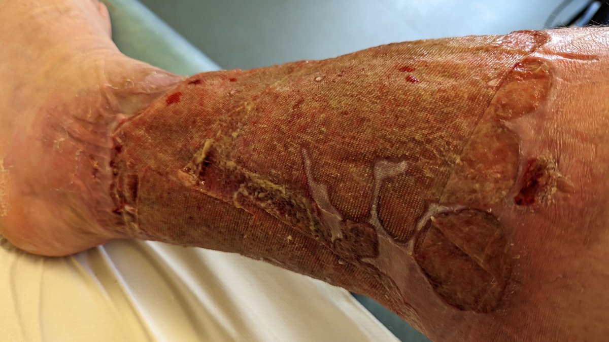 Andy Campbell tweet media