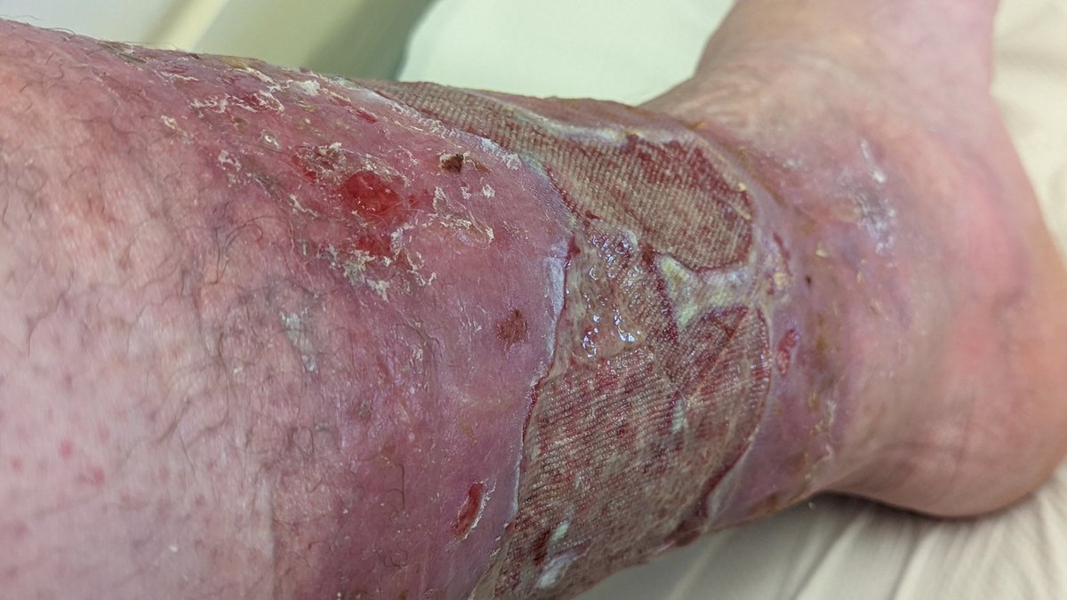 Andy Campbell tweet media