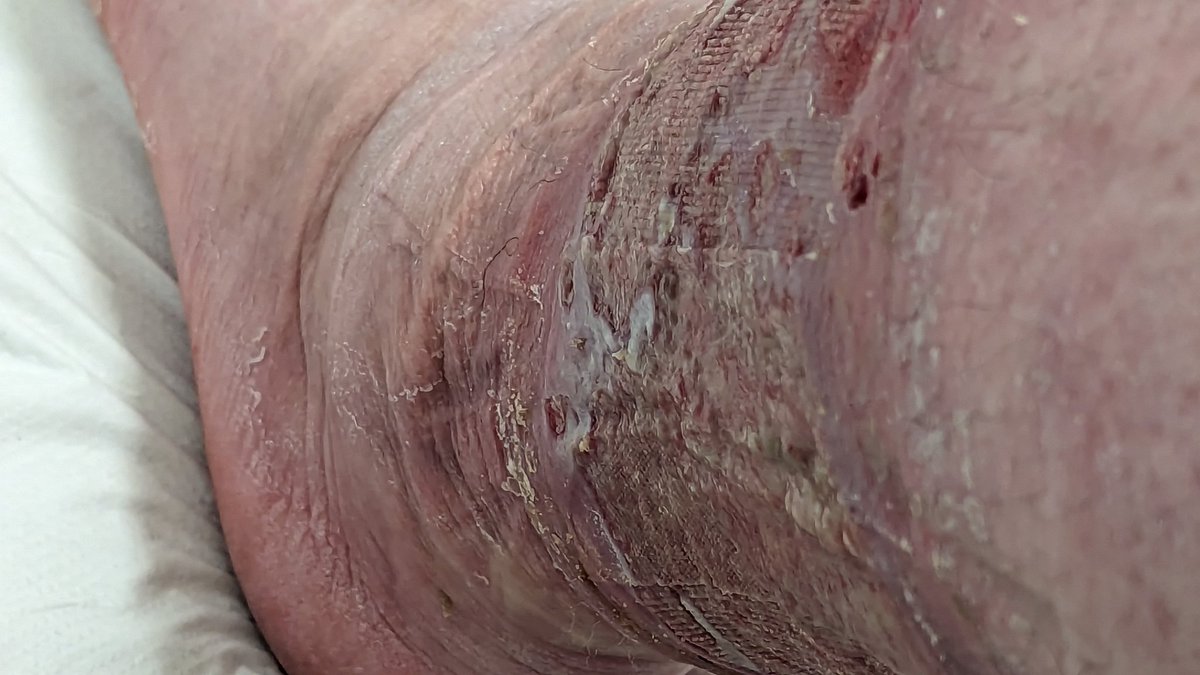 Andy Campbell tweet media