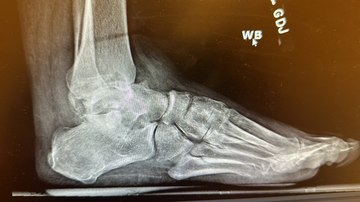 Christopher Miller, MD, MHS, FAAOS tweet media