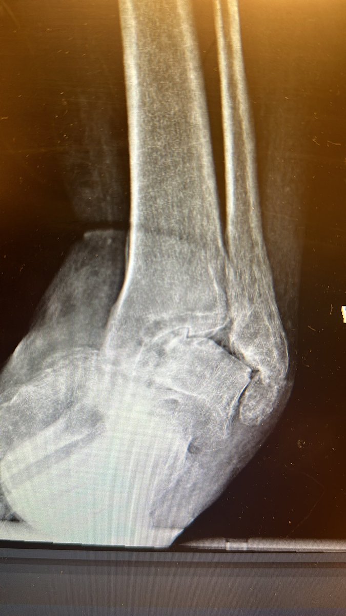 Christopher Miller, MD, MHS, FAAOS tweet media