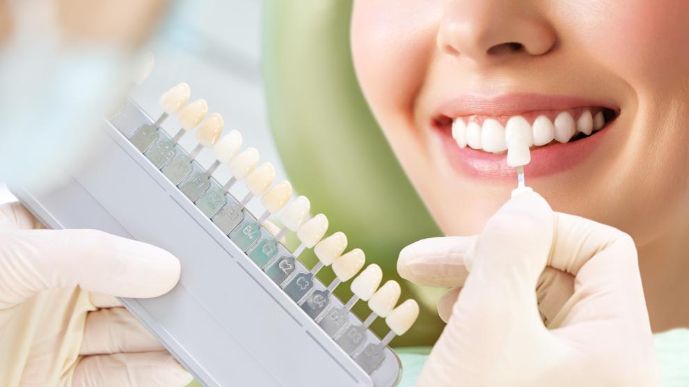 Blanqueamiento dental: ventajas y riesgos buff.ly/3DC5MBD