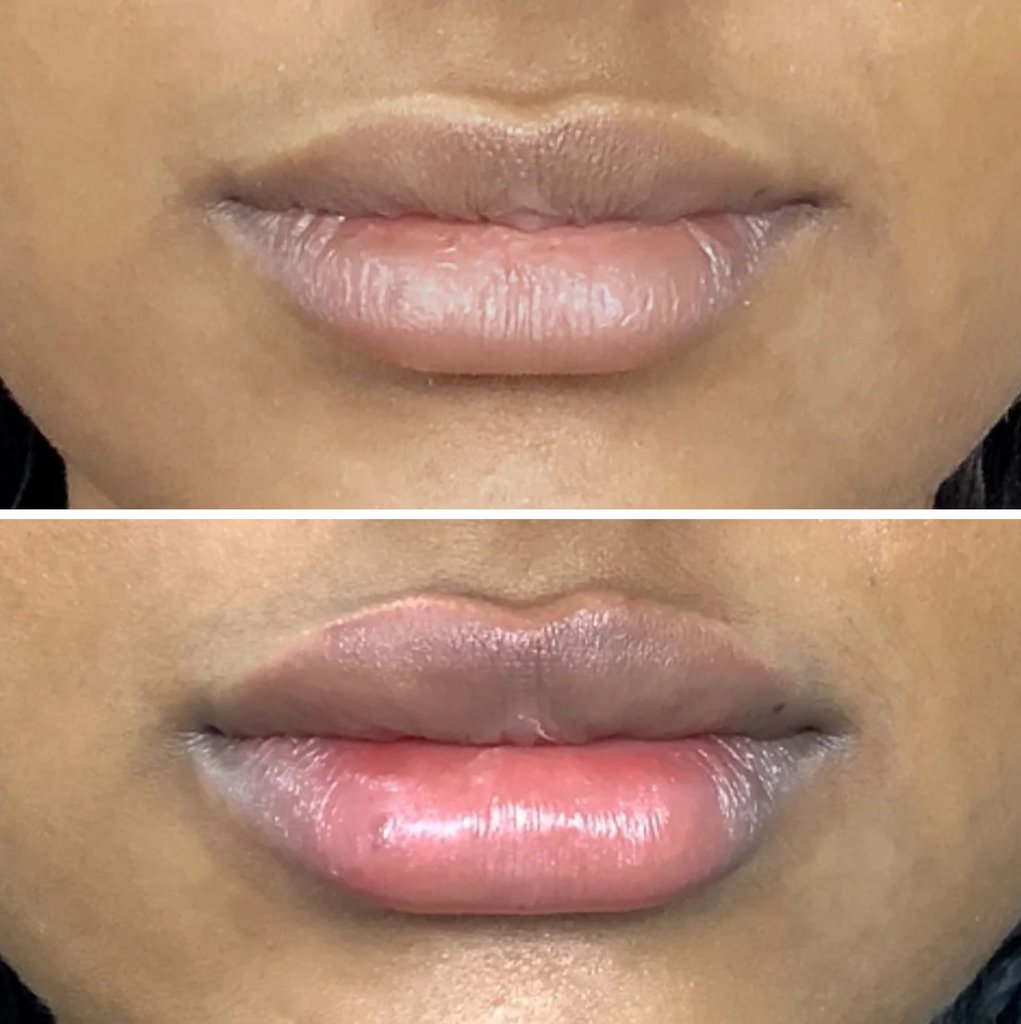 MD_Spa's tweet image. Contact us today:
Call: (780)9299797
Text: (780)9349021
DM: @MDSPALASER
Email: beaumont@mdspa.ca
Web: mdspa.ca

#edmonton #yeg #yeglocal #yegbusiness #alberta