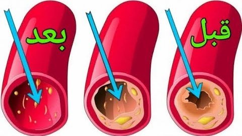 كيف تنظف شرايينك بشكل طبيعي وتقي نفسك من أمراض القلب ؟

تابعني وتابع السرد 

نصيحة...إذا مشغول فضلها...
