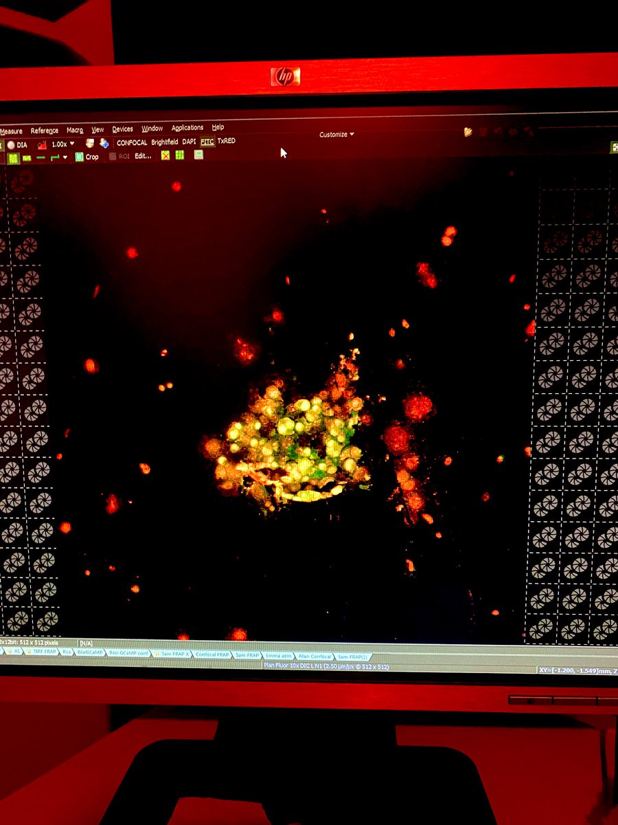 Dila_htn's tweet photo. Doing PhD is working 8 hours without sitting, eating or drinking coffee. And despite all this tiredness, a photo you take will make you happy and increase your determination to work! 😉👩🏻🔬
#DoingPhD #LiveDeadAssay #NeuronalCell #Biomaterials #Neuroscience https://t.co/0Hd8KHWoid