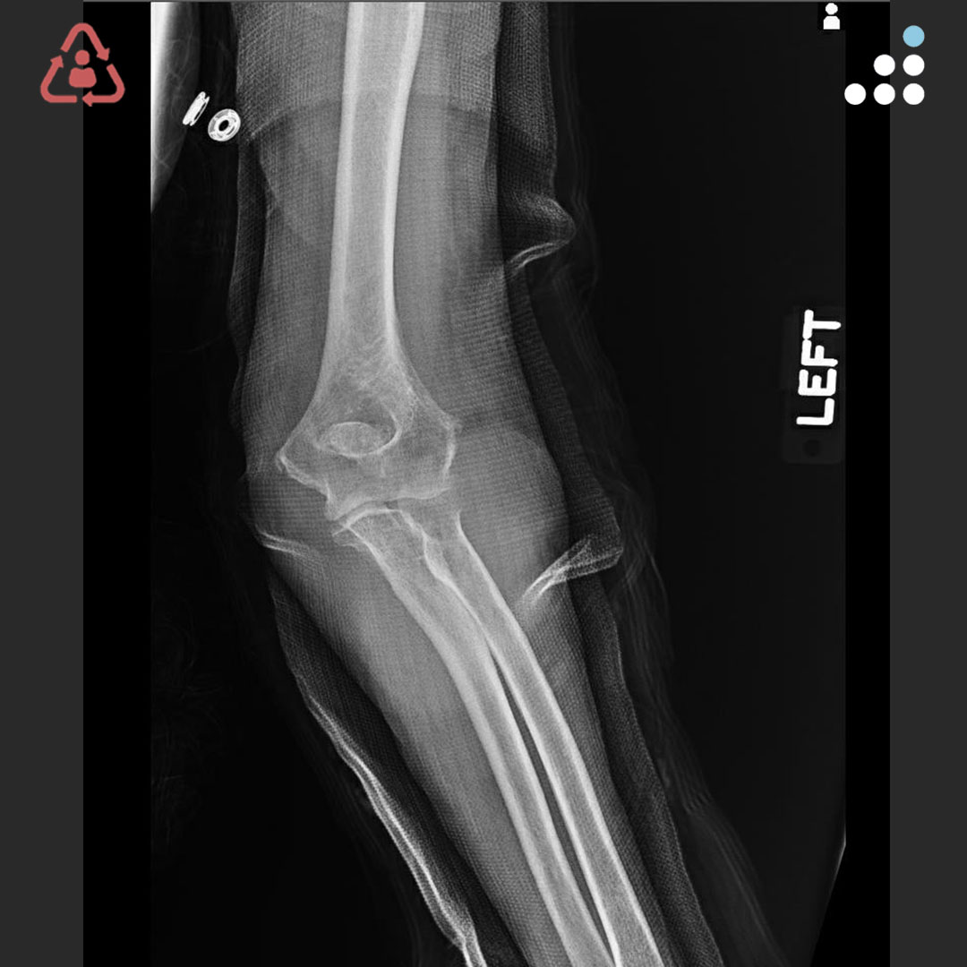 Orthobullets tweet media