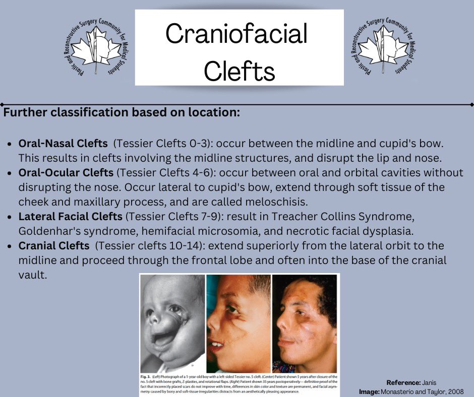 prscommunity's tweet photo. Educational post!!  Check out this fantastic post by Berit Sellars on Craniofacial Clefts (pt 1) https://t.co/WOOqB5CoAq