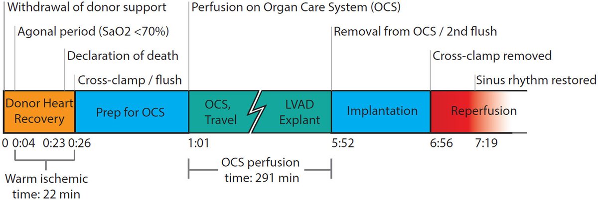 JHLT (@thejhlt) on Twitter photo The first pediatric #DCD heart transplantation using ex-vivo perfusion. Let’s make sure we don’t leave children behind in the new era of DCD heart donation and transplantation! <a href="/JacobNiall/">Jacob Niall Schroder</a>
🔗: jhltonline.org/article/S1053-… The first pediatric #DCD heart transplantation using ex-vivo perfusion. Let’s make sure we don’t leave children behind in the new era of DCD heart donation and transplantation! <a href="/JacobNiall/">Jacob Niall Schroder</a>
🔗: jhltonline.org/article/S1053-…