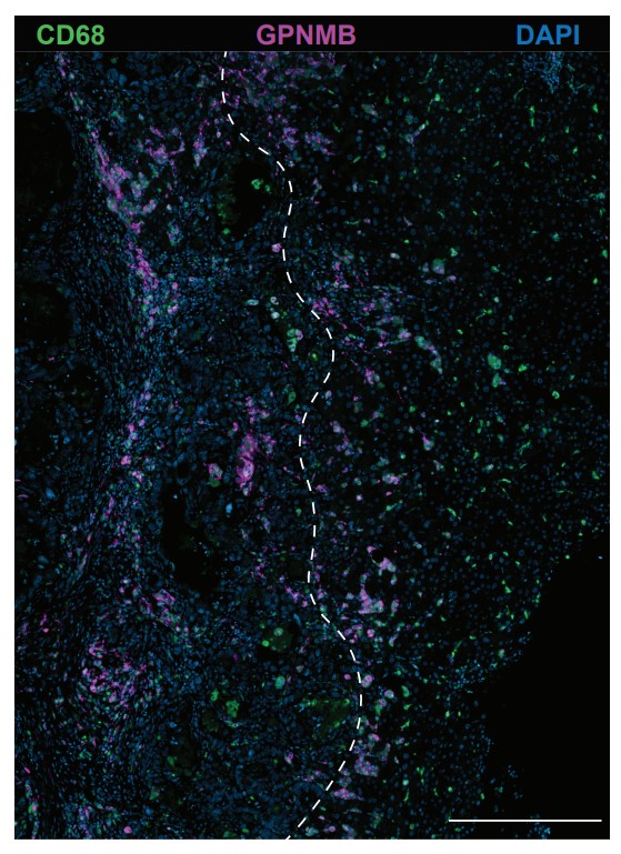 Cancer Immunology Research tweet media