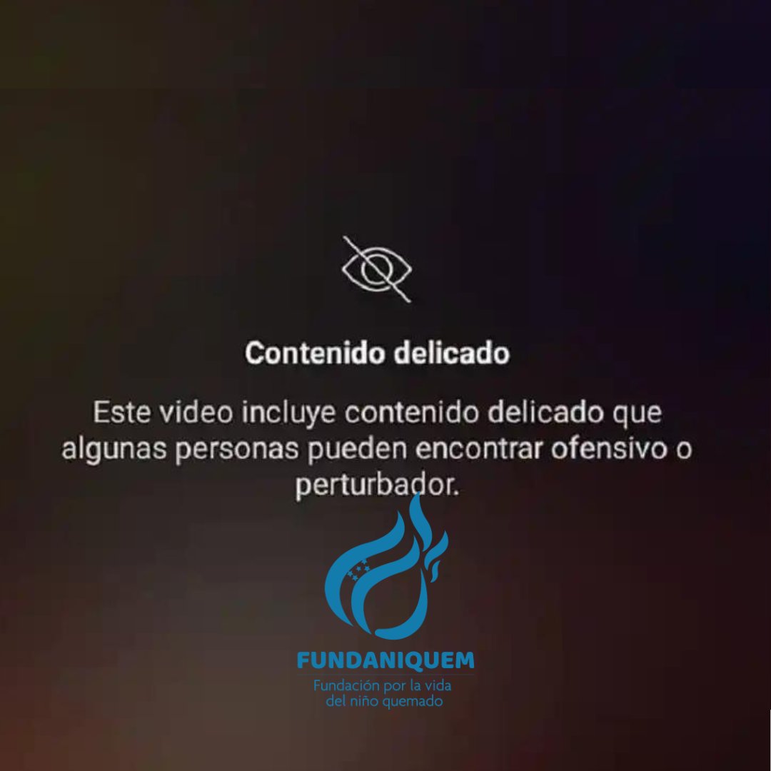 FUNDANIQUEM's tweet photo. Ingresa un menor a FUNDANIQUEM con quemaduras de segundo grado

Un menor de cuatro años de edad llegó en las últimas horas a la emergencia de FUNDANIQUEM,  con lesiones de segundo grado provocadas por un incendio  en su vivienda ubicada en Danlí, El Paraíso. https://t.co/PcHy5jY5Jl