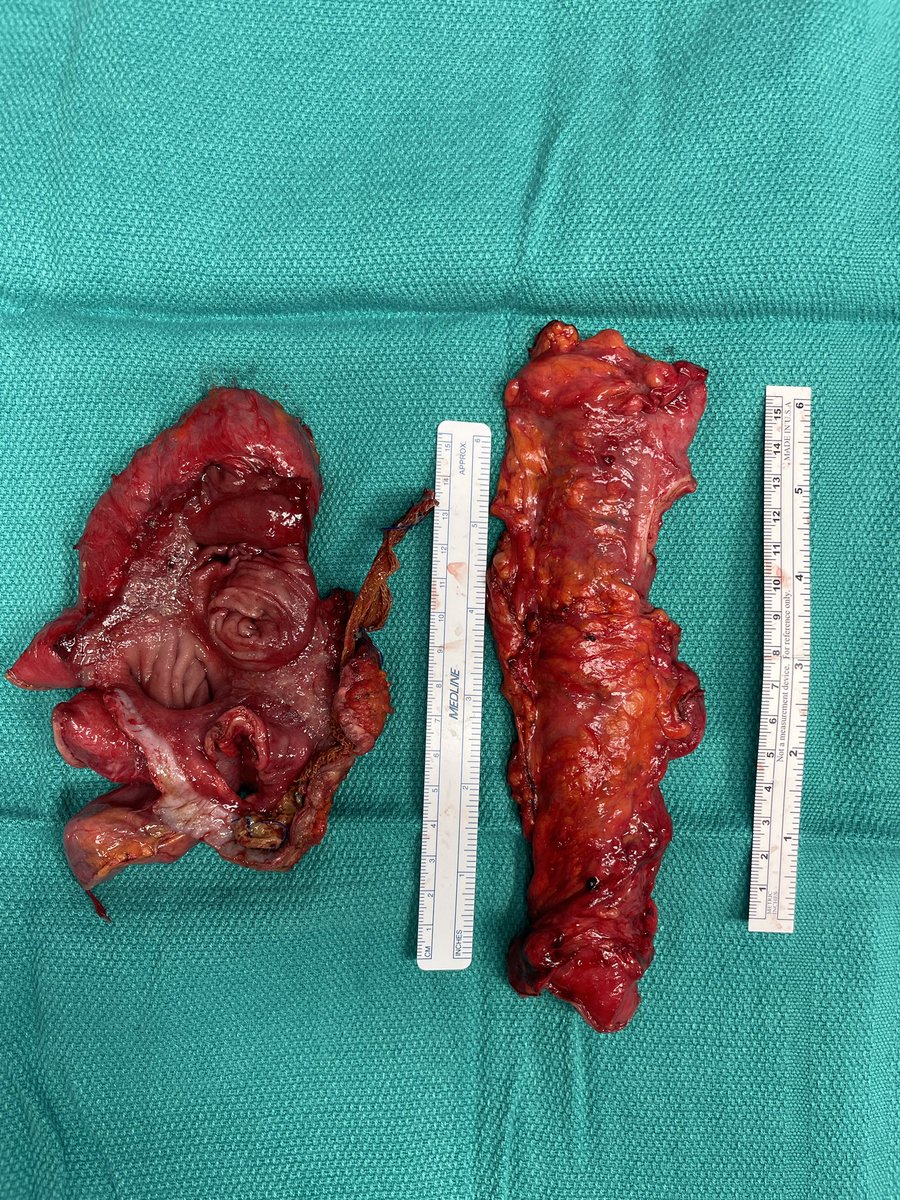 John Monson MD FRCS FACS FASCRS tweet media