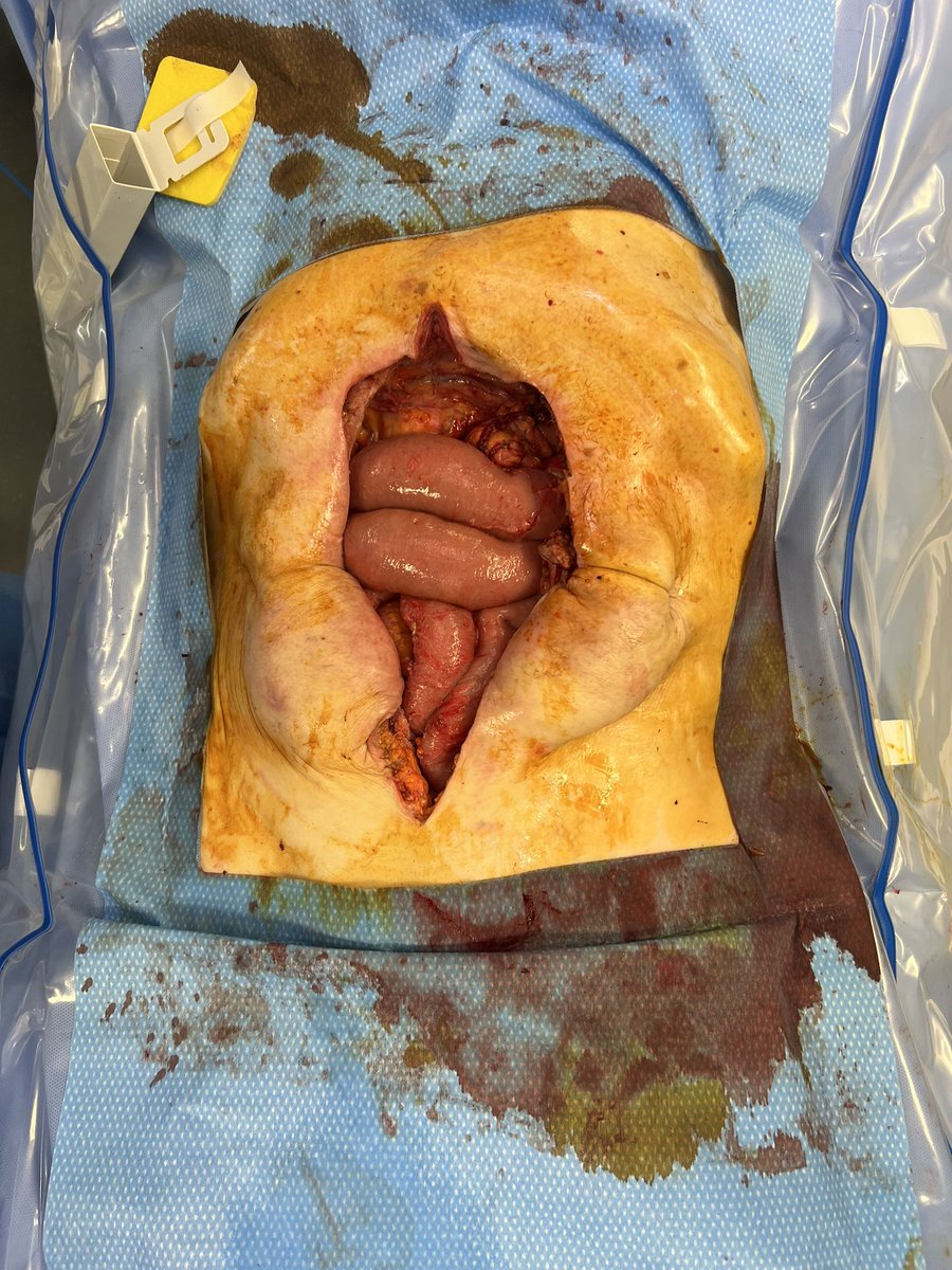 John Monson MD FRCS FACS FASCRS tweet media