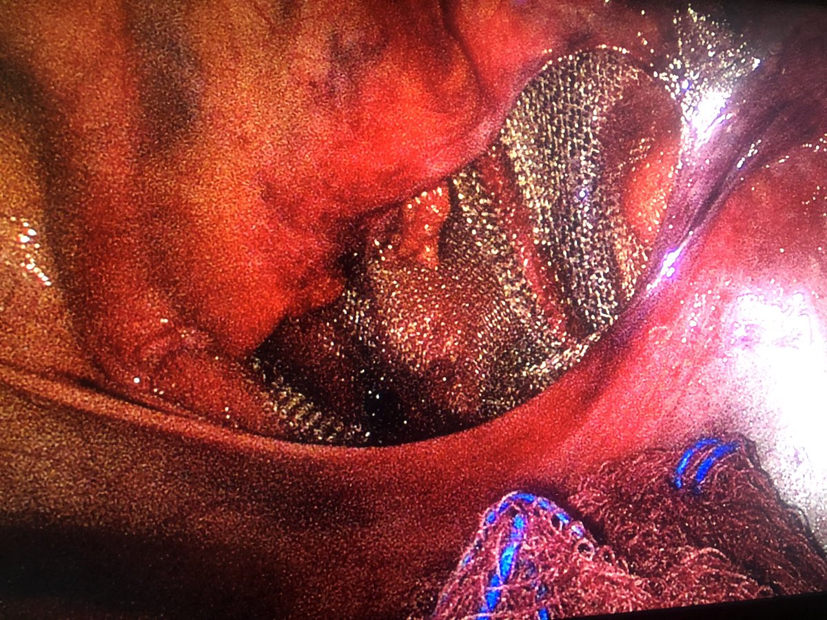 Dr. Patricio Toapanta tweet media