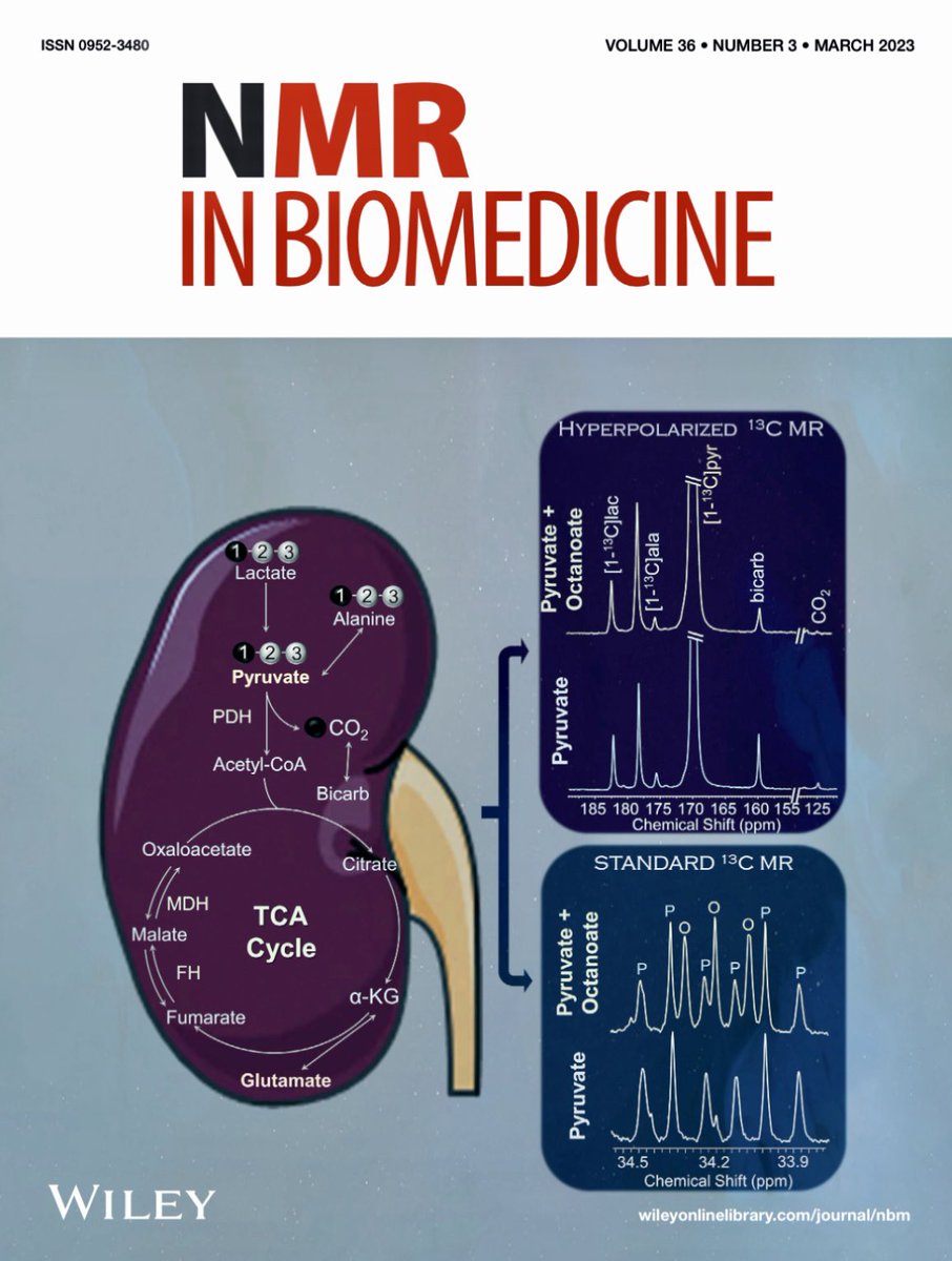 GauravSharmaPhD's tweet photo. Exciting news! Our latest research has been chosen for the cover of NMR in Biomedicine! Proud to contribute to the advancement of biomedical research and grateful for this recognition. #NMRinBiomedicine #BiomedicalResearch #HyperpolarizedMR #ScienceMakingADifference. https://t.co/VBk6cWnEUL