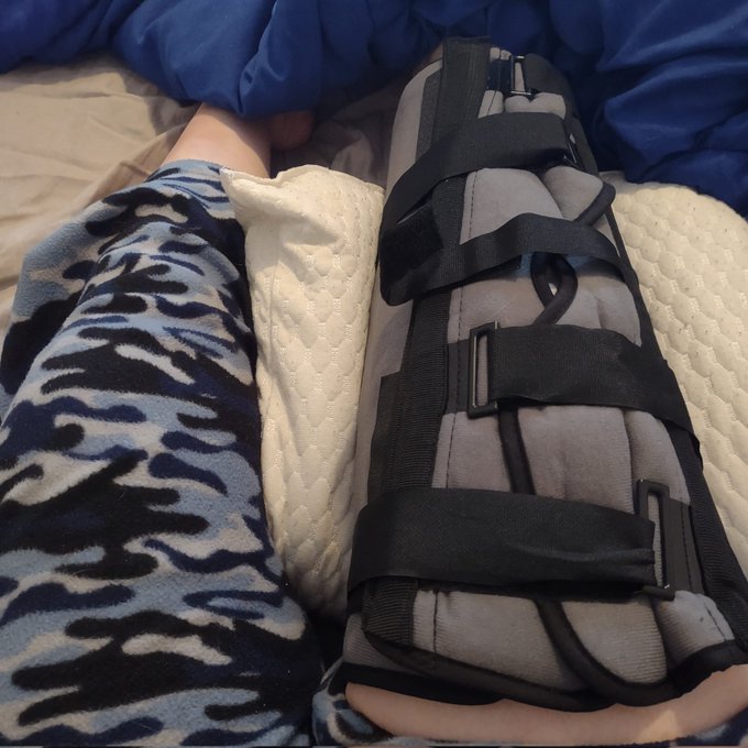 Tore a tendon in my knee and have a clot pressing on my nerve  am gonna probably need surgery  If anyone<a href="/tag/feet"class="tags"><span>#feet</span></a>