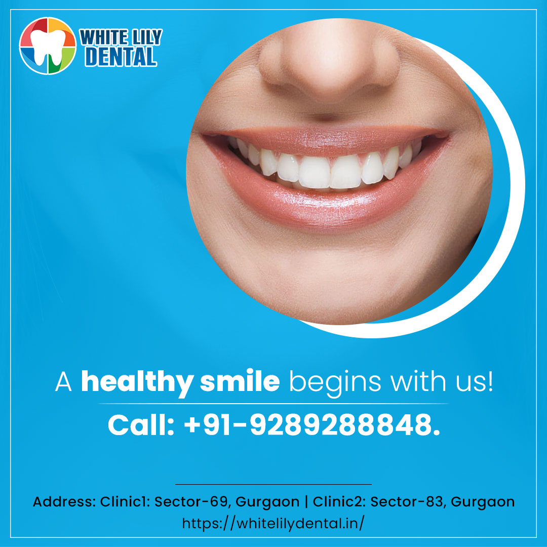 A healthy smile begins with us!!

Book Your Appointment Now! Call us at +91-9289288848 and for more info visit whitelilydental.in

#smilemakeover #oralhealth #dentistry #smile #dentist #bestdentalclinic #dentalimplants #rootcanaltreatment #teethstraightening #whitelilydental