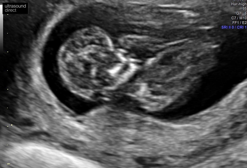 Jade Waring (Brock) tweet media