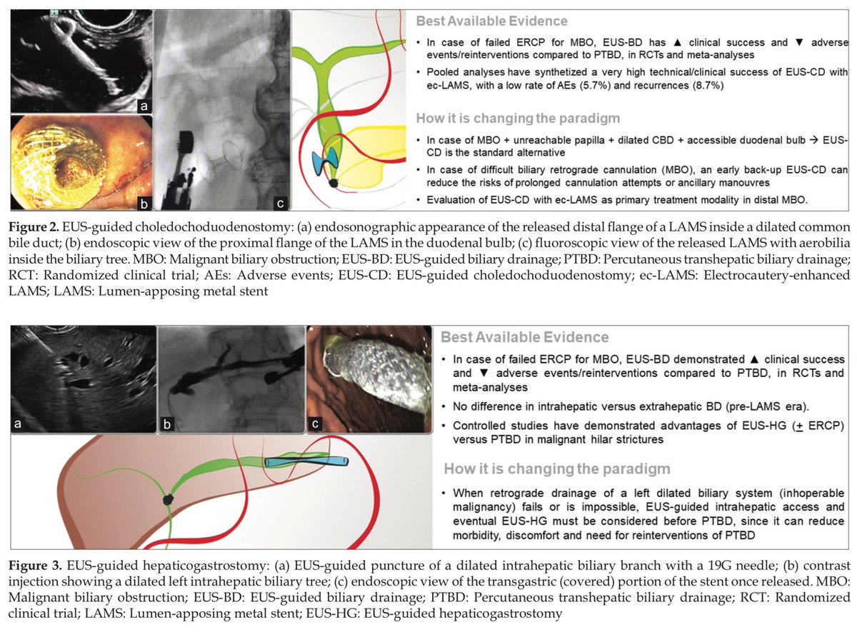 EUS & ERCP Master on Twitter "Current landscape of therapeutic EUS👇🏿