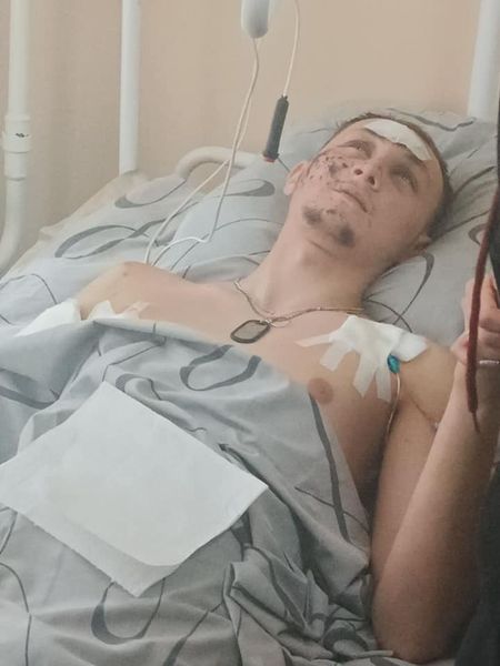 Панове, допоможіть своїми двома гривнями важкопораненому шосткинцю Володимиру Ядуті, наразі він перебуває у шпиталі та потребує допомоги.

Номер картки: 4731 2191 2276 7886 Ядута Оксана Василівна (мама).