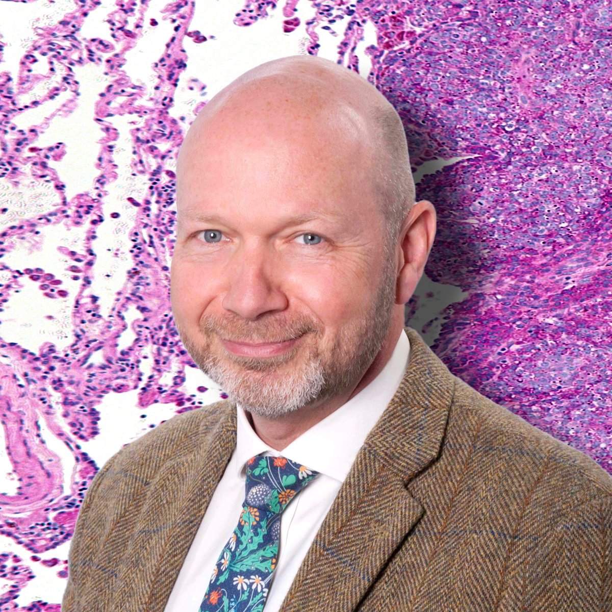 BCRT's tweet photo. 📣 BREAKING NEWS 📣 We're proud to share that we've awarded funding of over £200,000 to support the rEECur clinical trial led by Dr McCabe at @OfficialUoM &amp; @TheChristieNHS 🧪 Find out more this  #WorldCancerDay 👉https://t.co/1OfLh9pMWd #Research #Collaboration #UntilTheresACure https://t.co/ExHVL5C3ve