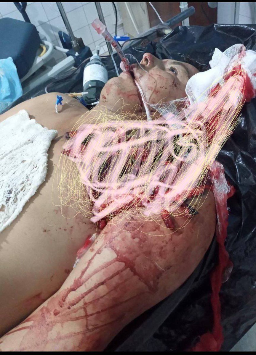 uatanym's tweet photo. @RKuanisheva @Navbahor @VOA_News @VOADirector @USAGMgov @GOVuz @POTUS @UsAmbUzbekistan @StateDRL @State_SCA @volker_turk @PowerUSAID @Navbahor What kind of people are you? You are always lying, #Bobur is lying, #Eshmatova is lying, Agzam, etc. Are there people among you who are telling the truth about the July events in #Karakalpakstan? https://t.co/57uLTA3qqL