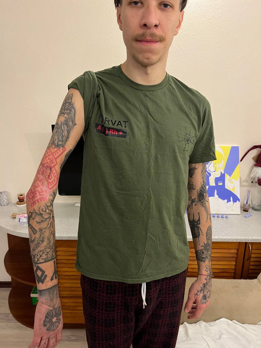 vsheredeha's tweet image. це Саша. він зловив осколок на висоті під їбучою Білогорівкою і тепер може залишитись без правої руки.

9 операцій, від біцепса майже нічого не залишилось, стиснути кулак він не може. рука потрохи всихає, а пальці не працюють. хлопцю 26 років, руку треба врятувати.