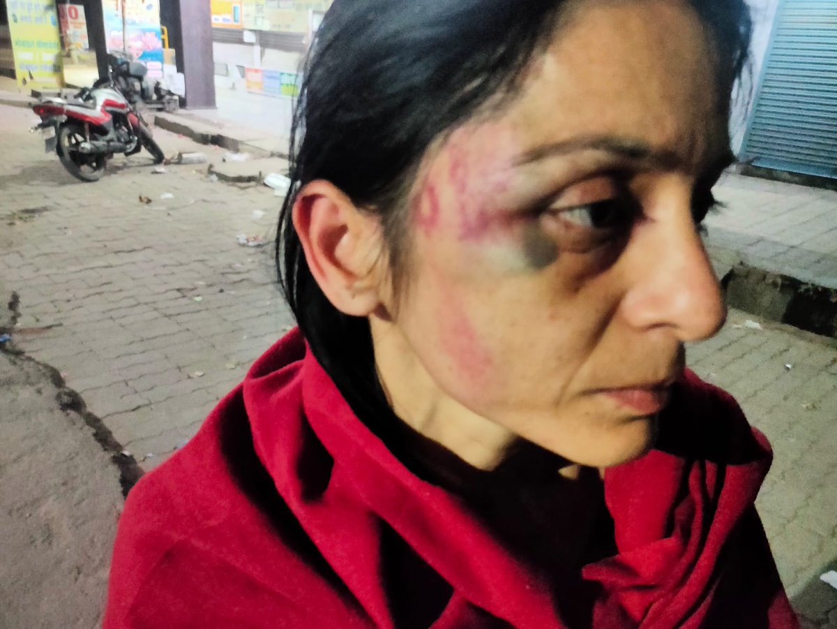 बेबाक पत्रकार (@noorulali99) on Twitter photo कानपुर। शर्म आती है पुलिस को पुलिस कहने में <a href="/Uppolice/">UP POLICE</a> <a href="/UMahilaayog/">UP_MahilaAyog</a>
दो वर्ष से विधवा महिला को किया जा रहा प्रताड़ित, पुलिस कर रही टालमटोली <a href="/kanpurnagarpol/">POLICE COMMISSIONERATE KANPUR NAGAR</a> <a href="/CMOfficeUP/">CM Office, GoUP</a>
थाना जूही के अंतर्गत किदवई नगर की रहने वाली महिला को इतनी बुरी तरह से पीटा कि चेहरा नीला पड़ गया <a href="/wpl1090/">Women & Child Security Org 1090 | UP Police</a> <a href="/dgpup/">DGP UP</a> कानपुर। शर्म आती है पुलिस को पुलिस कहने में <a href="/Uppolice/">UP POLICE</a> <a href="/UMahilaayog/">UP_MahilaAyog</a>
दो वर्ष से विधवा महिला को किया जा रहा प्रताड़ित, पुलिस कर रही टालमटोली <a href="/kanpurnagarpol/">POLICE COMMISSIONERATE KANPUR NAGAR</a> <a href="/CMOfficeUP/">CM Office, GoUP</a>
थाना जूही के अंतर्गत किदवई नगर की रहने वाली महिला को इतनी बुरी तरह से पीटा कि चेहरा नीला पड़ गया <a href="/wpl1090/">Women & Child Security Org 1090 | UP Police</a> <a href="/dgpup/">DGP UP</a>