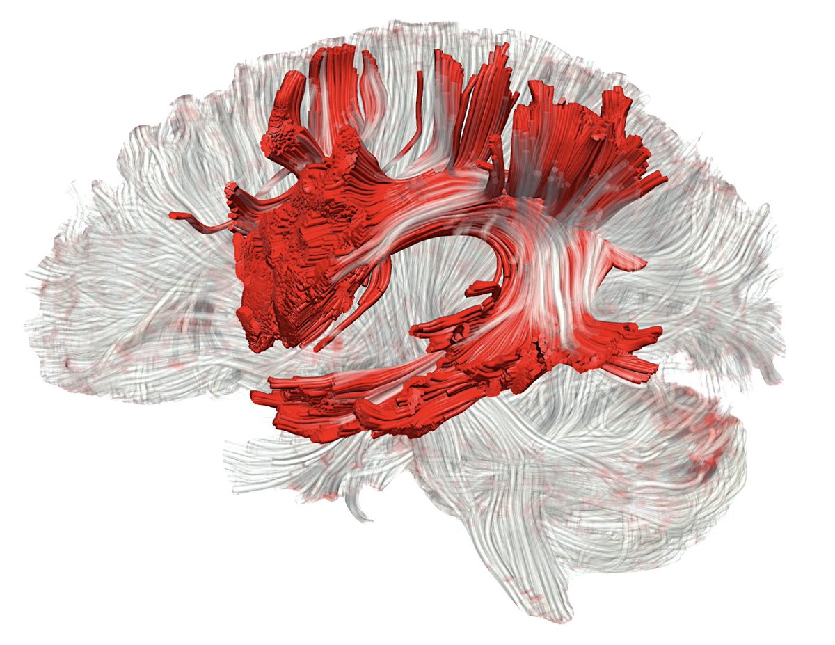StephForkel's tweet photo. #Callforpapers: Special Issue on an update on the #language #system. 

Methodological advances and the availability of large datasets offer the possibility of mapping language in the brain in unprecedented detail. 

Submit your exciting science: https://t.co/Jw5MXoaYus https://t.co/of7ClGIT96