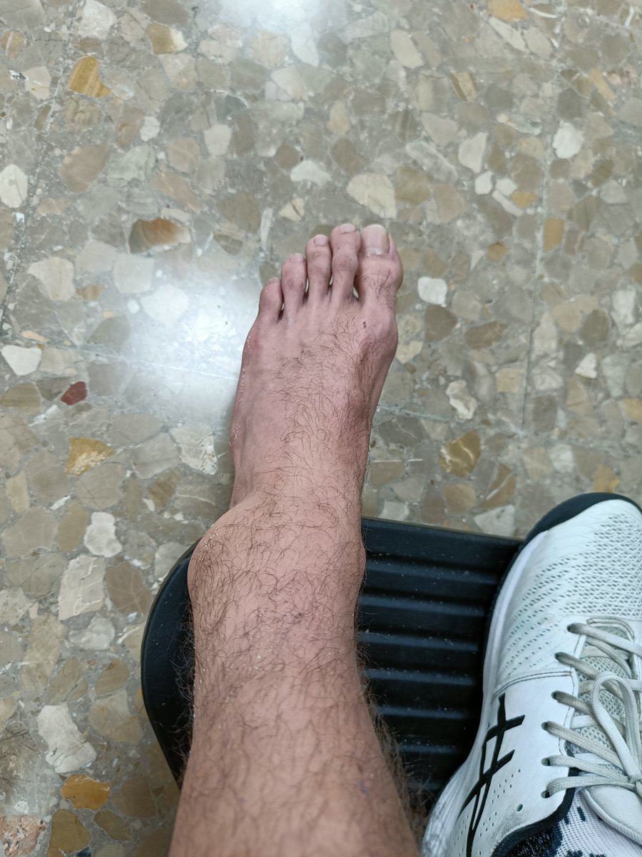 Is this were we ff and just go back to esports? 😂😣

It hurts like a motherfucker