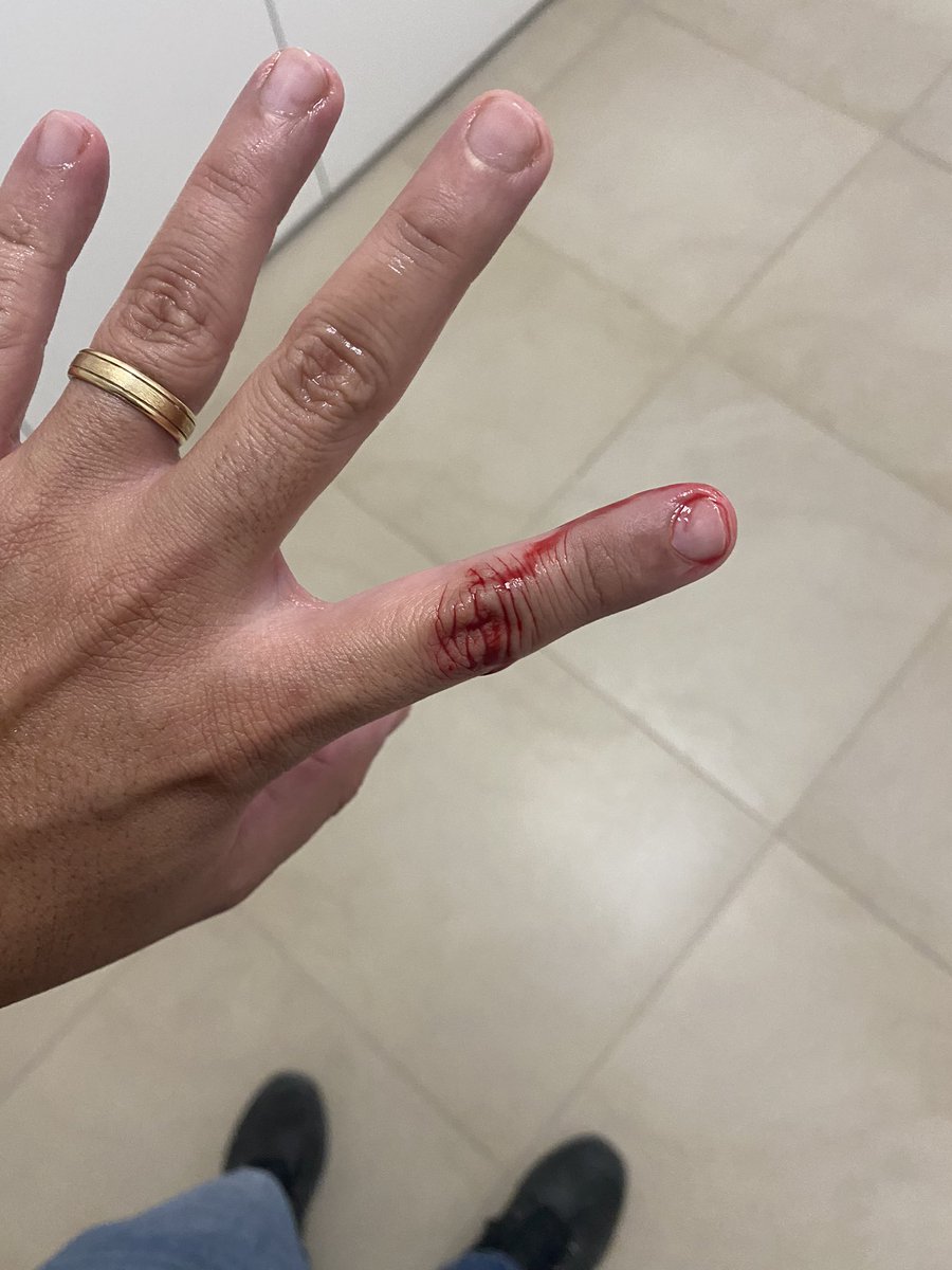 jccarpioa's tweet photo. Sigo desarmando destruyendo, como siempre, su recubrimiento metálico y con este me termino cortando, casi muero desangrado jaja https://t.co/9oXpykiMcL