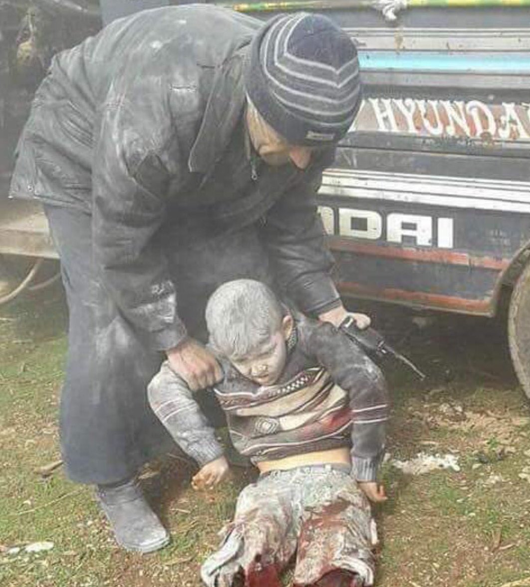 Zidane084's tweet photo. "Daddy, pick me up" a heart-wrenching photo from #Idlib, #Syria, in 2017, shows a young boy named Abdul Basit moments after losing his legs in a #Russian and regime attack on Habeet village. He implores his father to carry him as he can no longer move. #DontForget https://t.co/PJrJ3W0agu