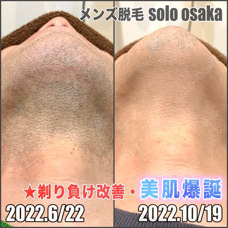 SoloOsaka's tweet photo. 40代ワイルド���パ！美肌爆誕 https://t.co/DzsoKVJp2C