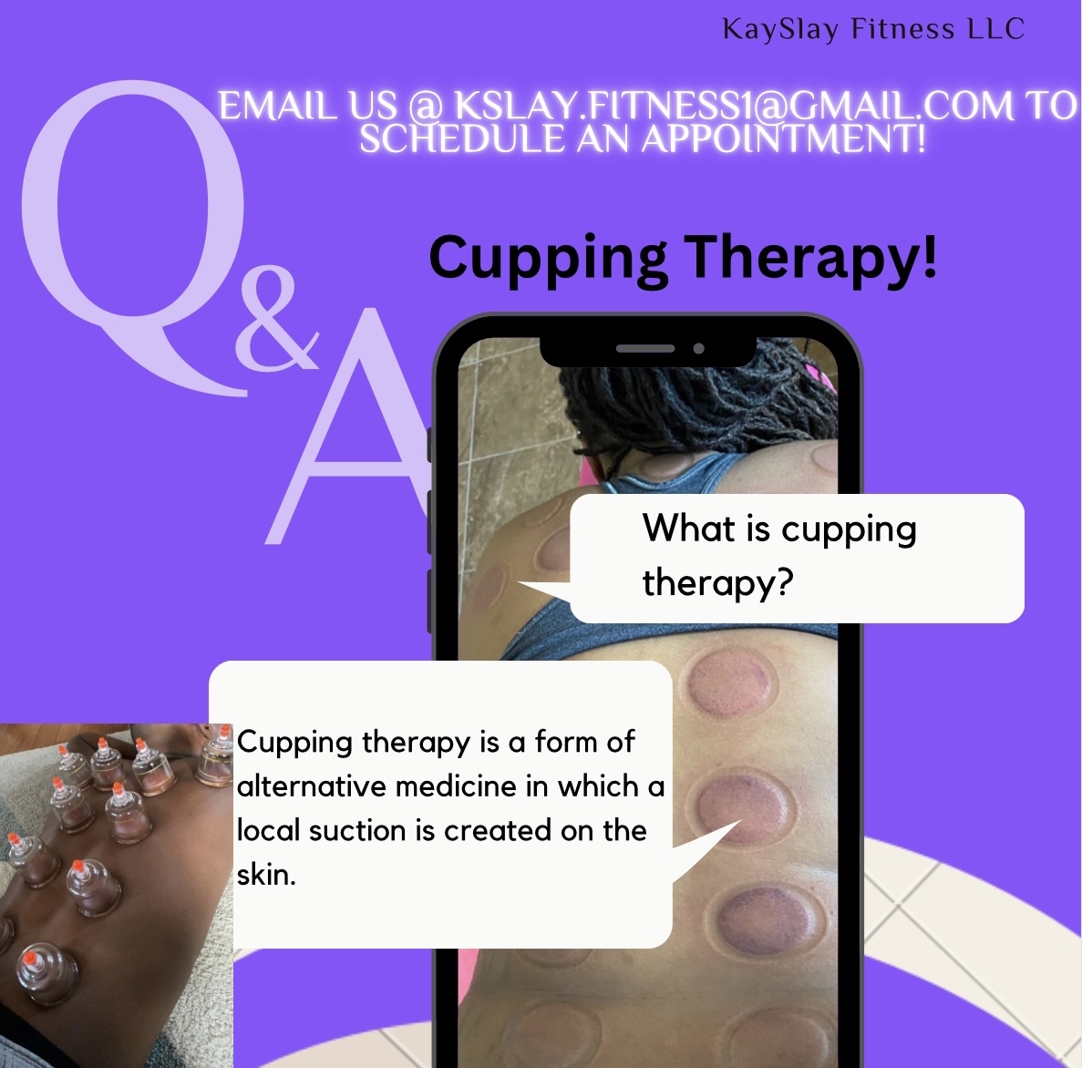 kayslayfitness's tweet image. Need to realize tension? Have a sore back or legs? Try out cupping!