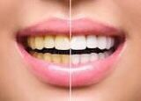 ad_marshalls's tweet photo. Make the right choice get rid of bad breath, toothache and other dental issues with PROKUDENT &amp;DONTODENT TOOTHPASTE ☺️😊😁#sompag_gh https://t.co/wBdecBqbD8