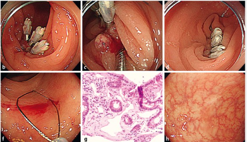 Mandeep Sawhney tweet media