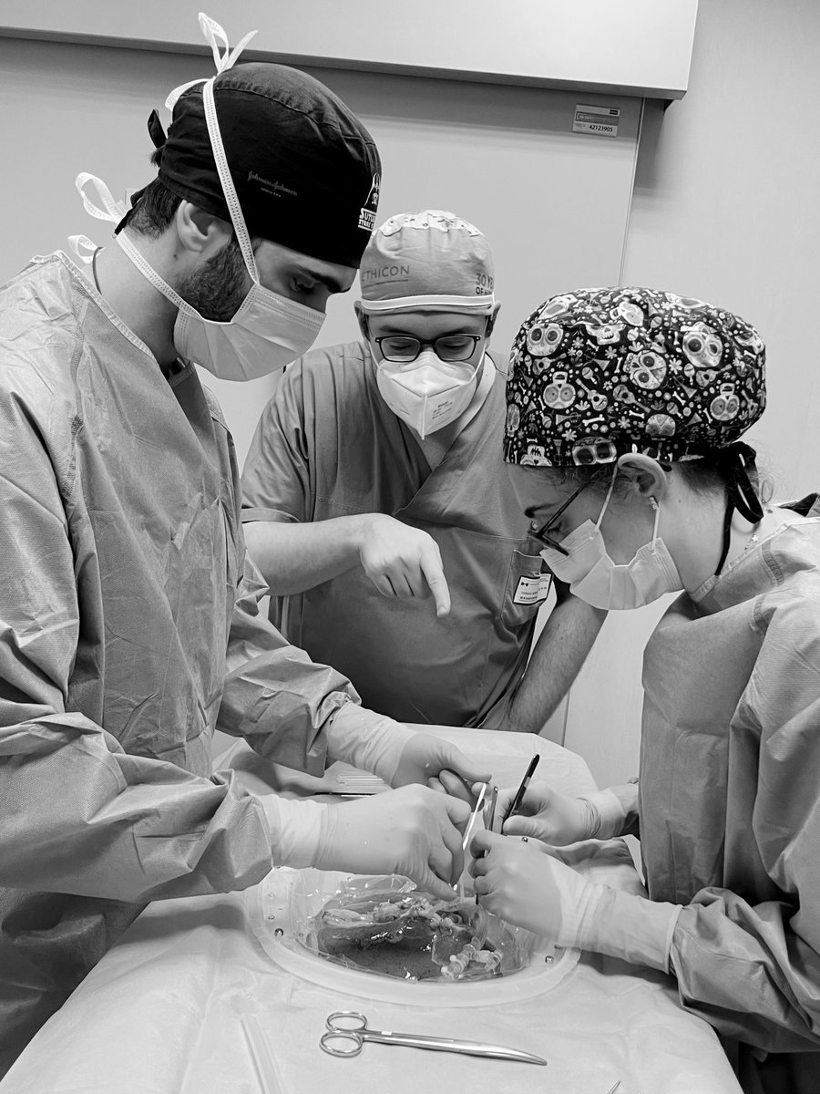 DeCarlis_R's tweet photo. Last night, we performed a #liver #transplant from a 84-year-old DCD donor using a combination of NRP and end-ischemic #HOPE. Do you have any age limit for DCD donors? @_LucaCigagna_ @GiudittaGrazia @Sa92_10 https://t.co/D9RcOuBCRE