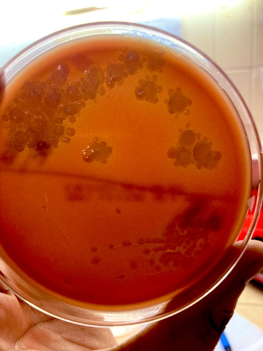Why does this happen🫧🫧
#microbiology