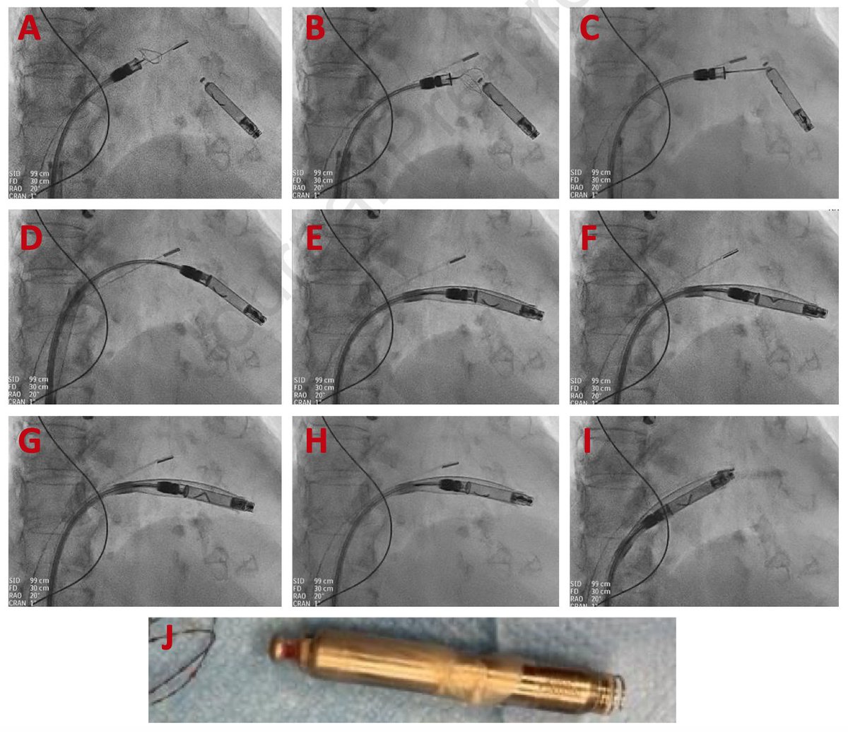 Heart Rhythm Case Reports tweet media