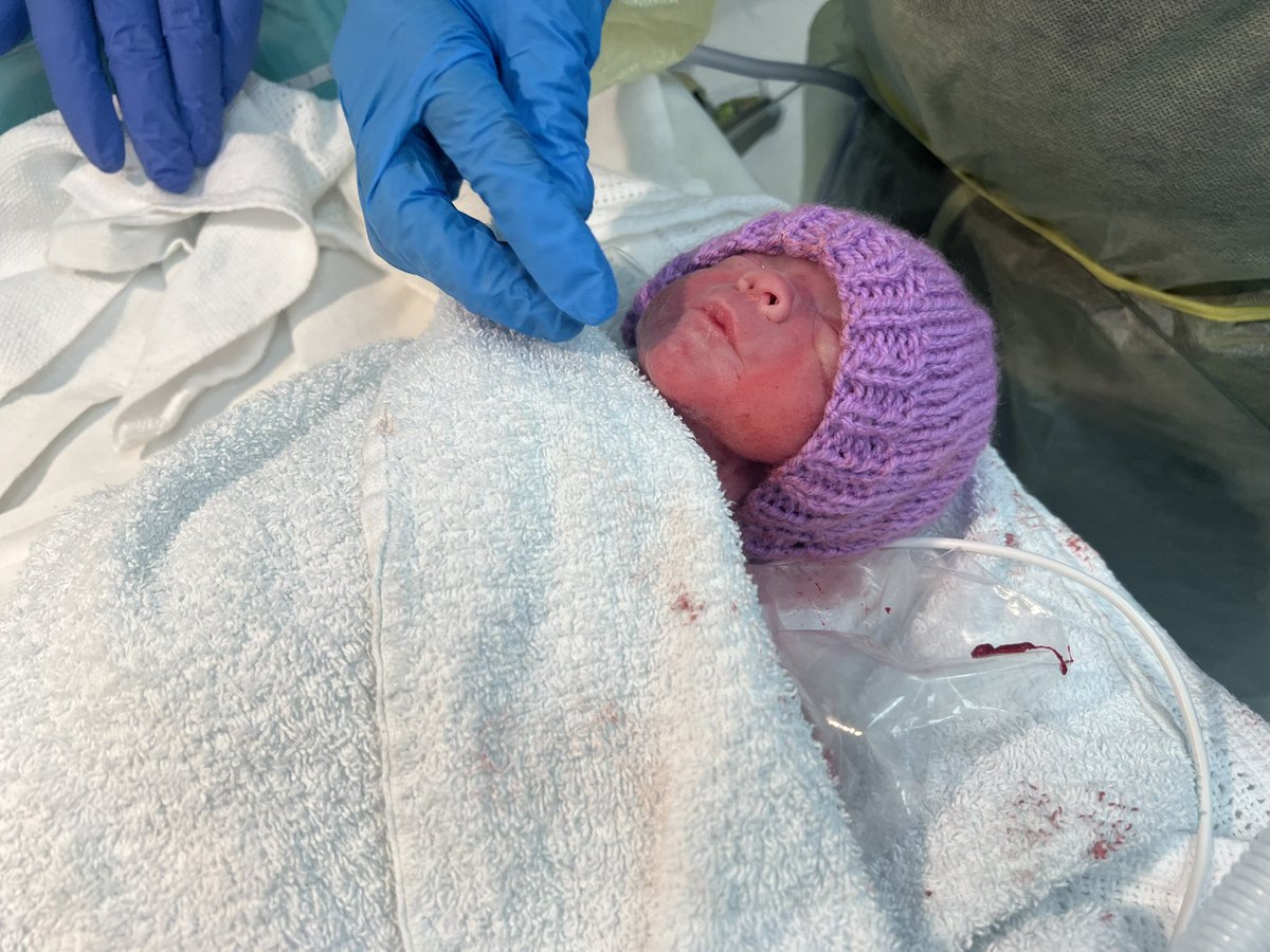 ryan_knox11's tweet photo. So 3 days ago my son was born on 1.2.23, the same day as one of my favourite artists @Harry_Styles was born, he’s meant to be born 26th April so he’s 28 weeks premature but he’s fighting and doing very well so far👶🏼💙 https://t.co/oZxcOal7NC