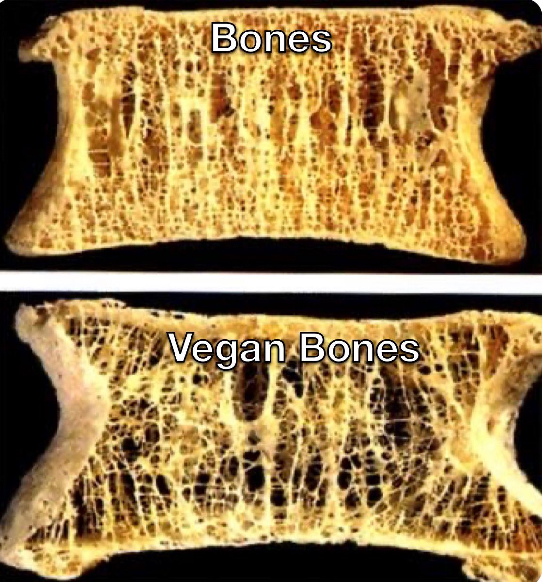 FUN FACT: Numerous studies have now shown consistent relationships between plant based diets and significantly increased fracture rates!!