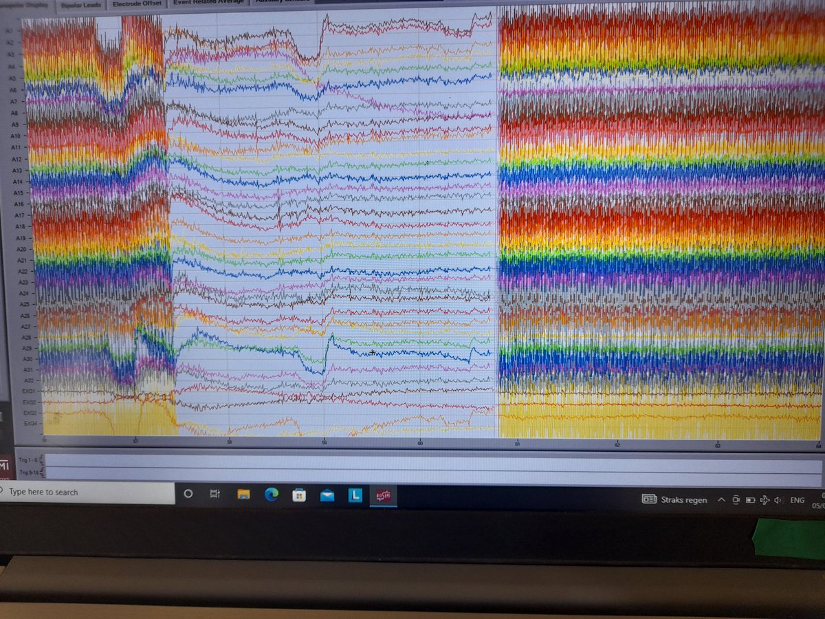 CasparEmilie's tweet image. Non-stationary power line noise vs autonomy of the batteries of the computer.
A daily fight ! 👊
#EEG
#neuroscience 
#fieldresearch