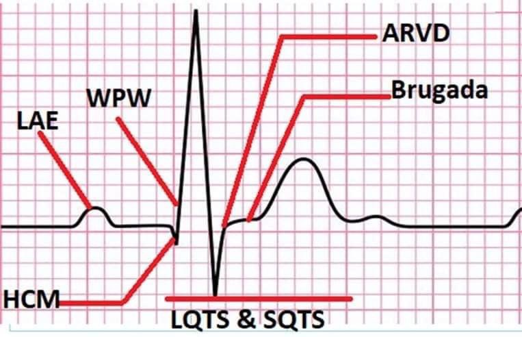 𝗥𝗲𝘀𝘂𝘀𝗠𝗲𝗱 (@resusmed) on Twitter photo 