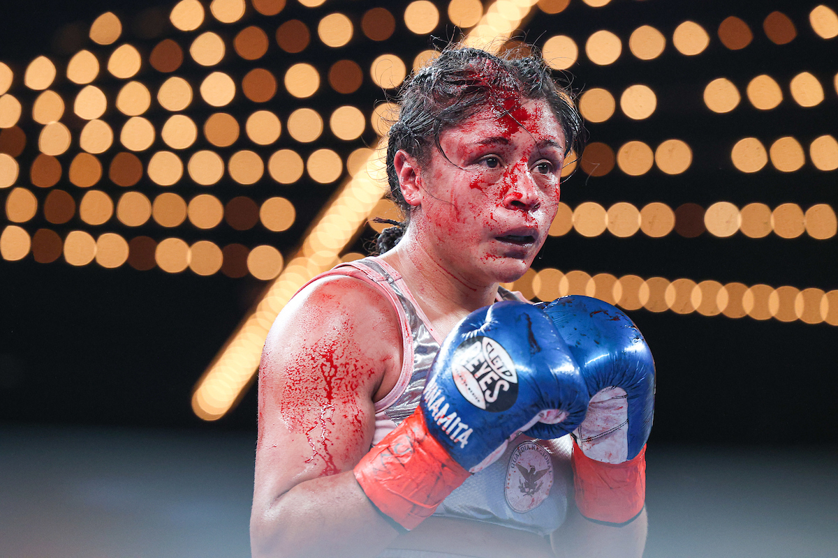 Erika Cruz's face. You don't play #boxing. (photo <a href="/muls96/">Ed Mulholland</a> for <a href="/MatchroomBoxing/">Matchroom Boxing</a>) #SerranoCruz